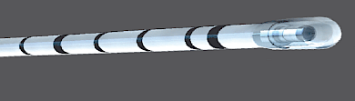 Corona Fistül Fiber